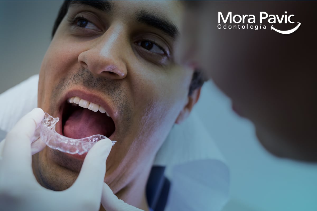 temporomandibular