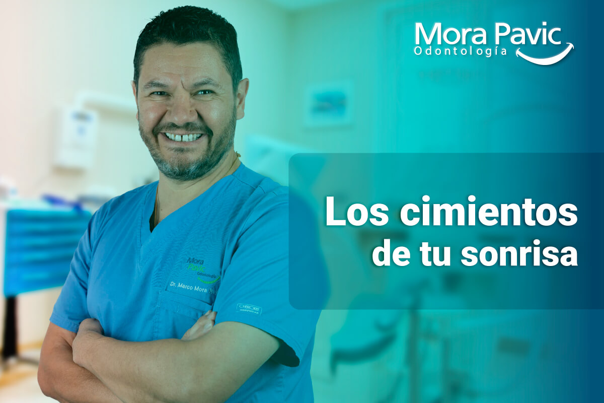 Los cimientos de tu sonrisa