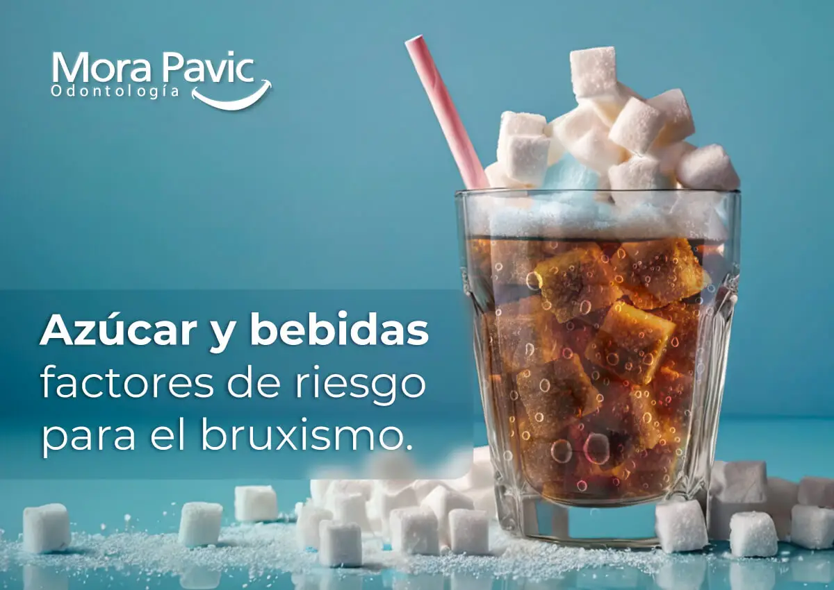 Azúcar-y-bebidas-factores-de-riesgo-para-el-bruxismo