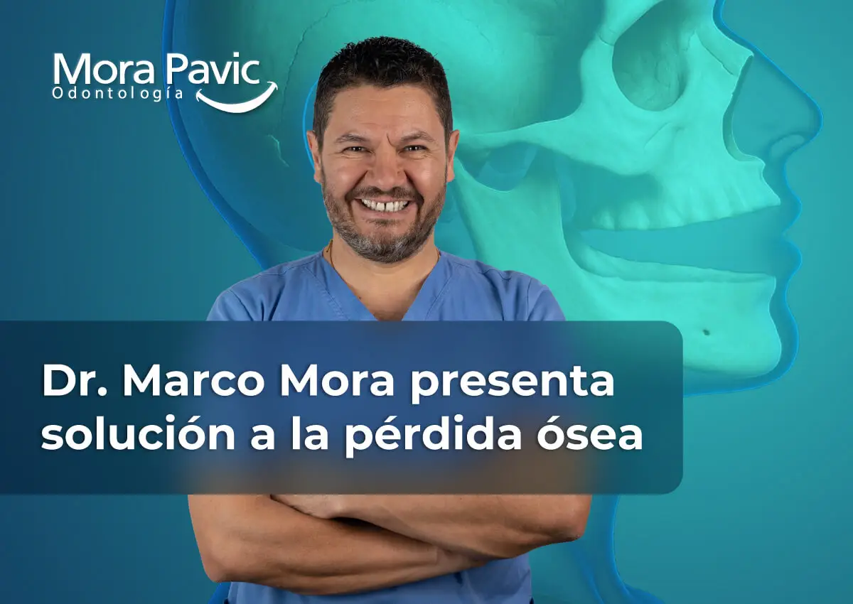 Implantes-cigomaticos