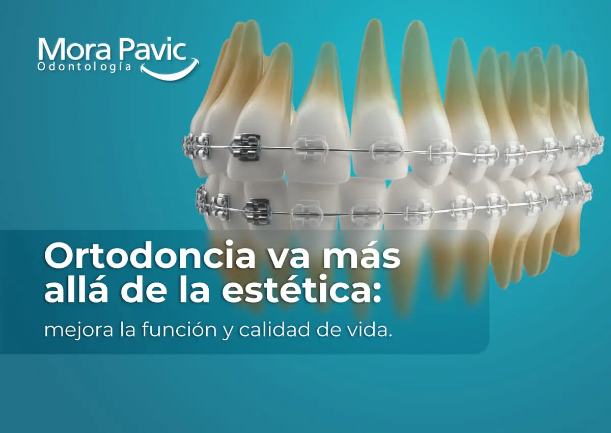 Ortodoncia-va-más-allá-de-la-estética--mejora-la-función-y-calidad-de-vida--