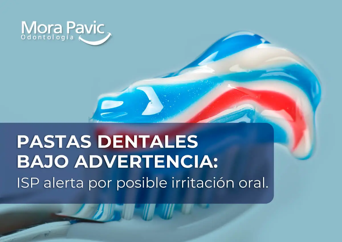 pastas-dentales-bajo-advertencia--ISP-alerta-por-posible-irritación-oral