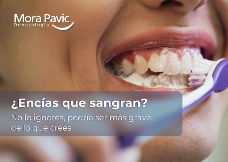 ¿Encías-que-sangran--No-lo-ignores,-podría-ser-más-grave-de-lo-que-crees
