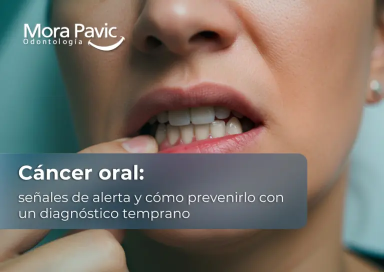 Cáncer-oral--señales-de-alerta-y-cómo-prevenirlo-con-un-diagnóstico-temprano